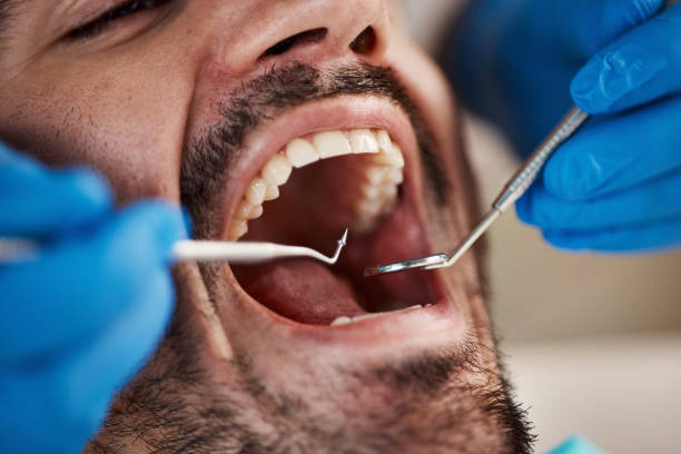 Best Dentist for Tooth Abscess  in Charlestown, IN