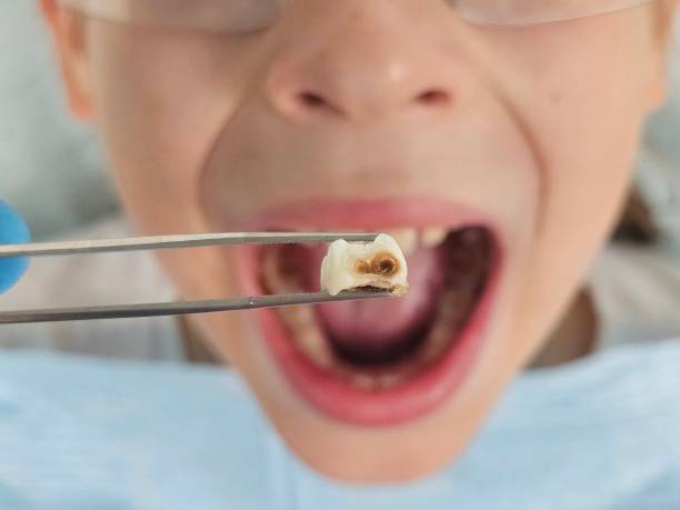Best Dentist for Severe Toothache  in Charlestown, IN