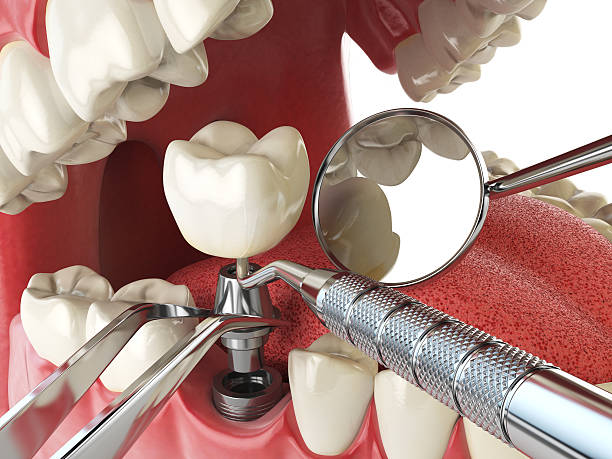 Best Emergency Gum Pain Relief  in Charlestown, IN